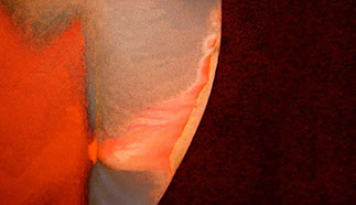 Zahnarztpraxis Dr. Isabel Selmair - München, Schwabing / Minimalinvasive Füllungstechniken, Karies