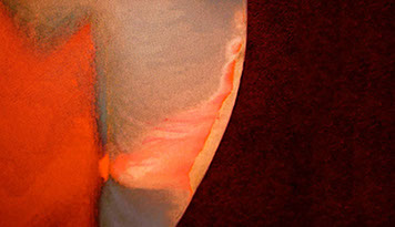 Zahnarztpraxis Dr. Isabel Selmair - München, Schwabing / Minimalinvasive Füllungstechniken, Karies