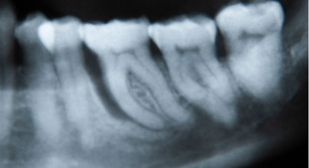 Zahnarztpraxis Dr. Isabel Selmair - München, Schwabing / Parodontitisbehandlung