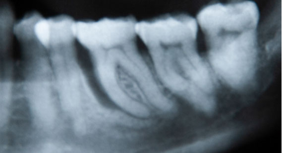 Zahnarztpraxis Dr. Isabel Selmair - München, Schwabing / Parodontitisbehandlung