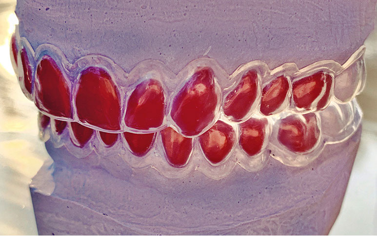 Zahnarztpraxis Dr. Isabel Selmair - München, Schwabing / Ästhetische Rekonstruktionen, Bleaching