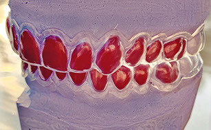 Zahnarztpraxis Dr. Isabel Selmair - München, Schwabing / Ästhetische Rekonstruktionen, Bleaching