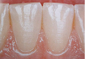 Zahnarztpraxis Dr. Isabel Selmair - München, Schwabing / Parodontitisbehandlung