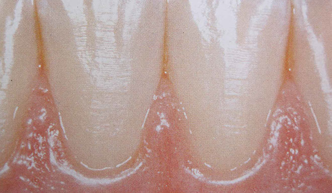 Zahnarztpraxis Dr. Isabel Selmair - München, Schwabing / Parodontitisbehandlung