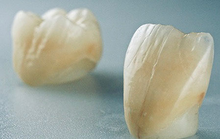 Zahnarztpraxis Dr. Isabel Selmair - München, Schwabing / Zahnersatz, Kronen Brücken