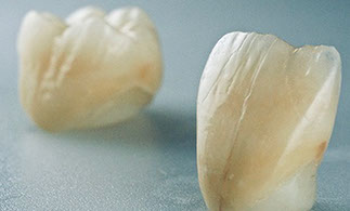 Zahnarztpraxis Dr. Isabel Selmair - München, Schwabing / Zahnersatz, Kronen Brücken