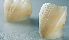 Zahnarztpraxis Dr. Isabel Selmair - München, Schwabing / Alterszahnheilkunde, Zahnersatz