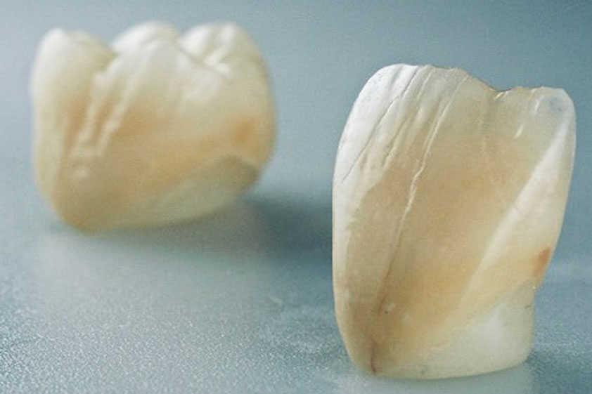 Zahnarztpraxis Dr. Isabel Selmair - München, Schwabing / Zahnersatz, Kronen Brücken