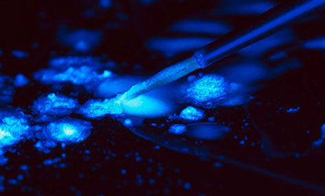 Zahnarztpraxis Dr. Isabel Selmair - München, Schwabing / Zahnersatz, Kronen Brücken