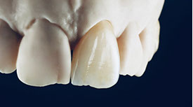 Zahnarztpraxis Dr. Isabel Selmair - München, Schwabing / Zahnersatz, Kronen Brücken