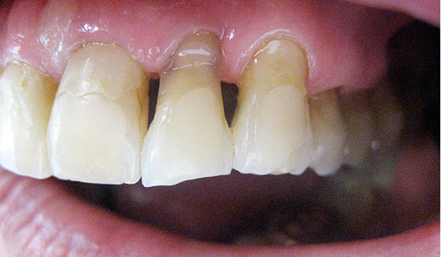 Zahnarztpraxis Dr. Isabel Selmair - München, Schwabing / Alterszahnheilkunde, Zahnersatz