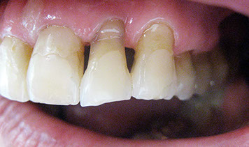 Zahnarztpraxis Dr. Isabel Selmair - München, Schwabing / Alterszahnheilkunde, Zahnersatz