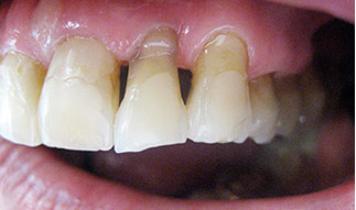 Zahnarztpraxis Dr. Isabel Selmair - München, Schwabing / Alterszahnheilkunde, Zahnersatz