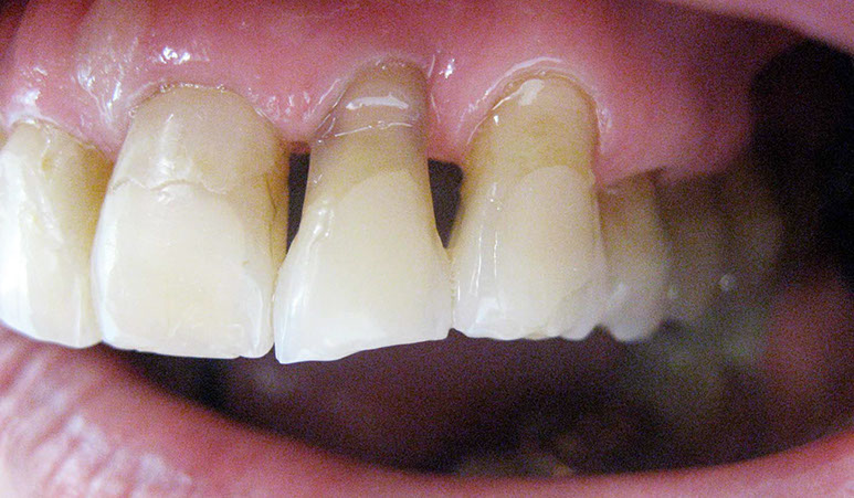 Zahnarztpraxis Dr. Isabel Selmair - München, Schwabing / Alterszahnheilkunde, Zahnersatz