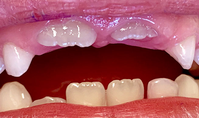 Zahnarztpraxis Dr. Isabel Selmair - München, Schwabing / Kinderzahnheilkunde