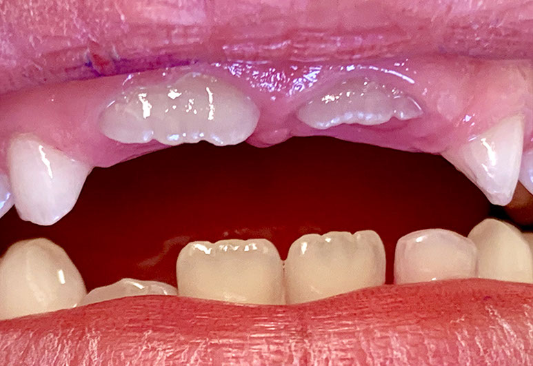 Zahnarztpraxis Dr. Isabel Selmair - München, Schwabing / Kinderzahnheilkunde