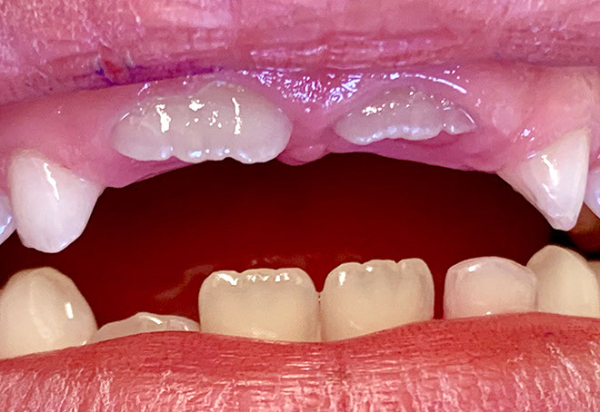 Zahnarztpraxis Dr. Isabel Selmair - München, Schwabing / Kinderzahnheilkunde