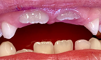 Zahnarztpraxis Dr. Isabel Selmair - München, Schwabing / Kinderzahnheilkunde