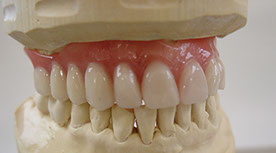 Zahnarztpraxis Dr. Isabel Selmair - München, Schwabing / Zahnersatz, Totalprothese