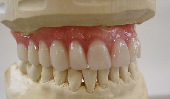 Zahnarztpraxis Dr. Isabel Selmair - München, Schwabing / Alterszahnheilkunde, Zahnreinigung