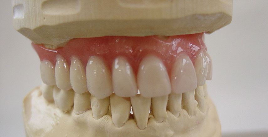 Zahnarztpraxis Dr. Isabel Selmair - München, Schwabing / Zahnersatz, Totalprothese