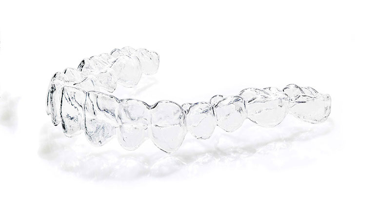 Zahnarztpraxis Dr. Isabel Selmair - München, Schwabing / Schienentherapie, Aligner Therapie