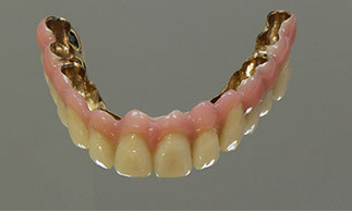 Zahnarztpraxis Dr. Isabel Selmair - München, Schwabing / Alterszahnheilkunde, Zahnreinigung