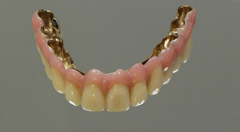 Zahnarztpraxis Dr. Isabel Selmair - München, Schwabing / Alterszahnheilkunde, Zahnreinigung