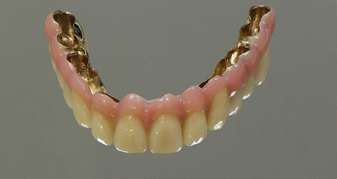 Zahnarztpraxis Dr. Isabel Selmair - München, Schwabing / Alterszahnheilkunde, Zahnreinigung