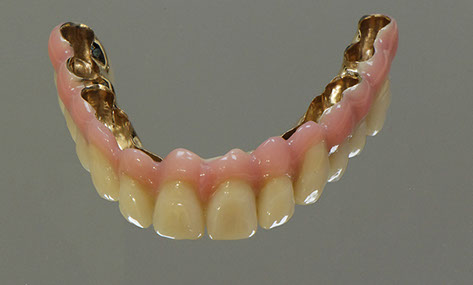 Zahnarztpraxis Dr. Isabel Selmair - München, Schwabing / Alterszahnheilkunde, Zahnreinigung