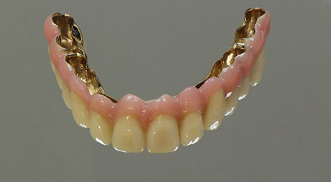 Zahnarztpraxis Dr. Isabel Selmair - München, Schwabing / Alterszahnheilkunde, Zahnersatz