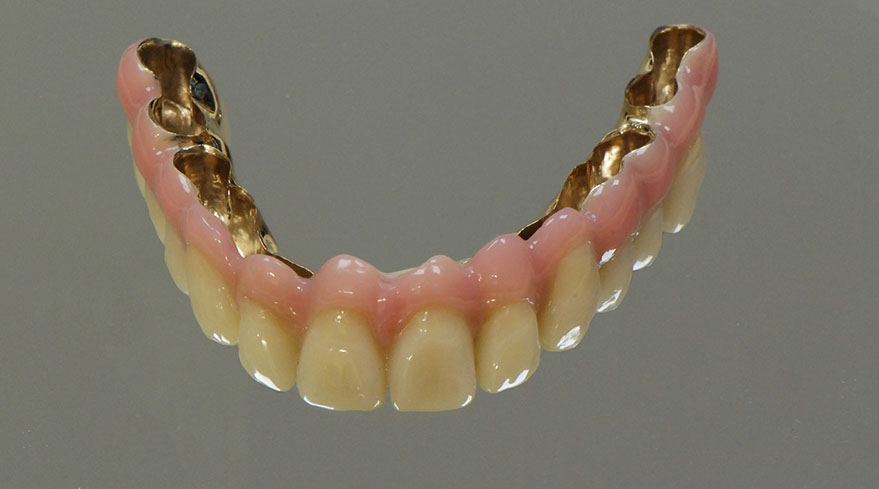 Zahnarztpraxis Dr. Isabel Selmair - München, Schwabing / Alterszahnheilkunde, Zahnersatz