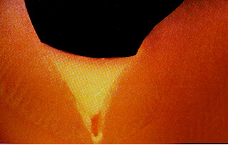 Zahnarztpraxis Dr. Isabel Selmair - München, Schwabing / Vorsorge (Prophylaxe), Fissuren und Versiegelungen