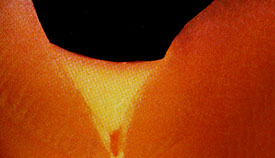 Zahnarztpraxis Dr. Isabel Selmair - München, Schwabing / Vorsorge (Prophylaxe), Fissuren und Versiegelungen