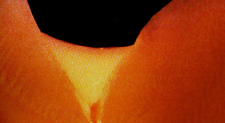 Zahnarztpraxis Dr. Isabel Selmair - München, Schwabing / Vorsorge (Prophylaxe), Fissuren und Versiegelungen