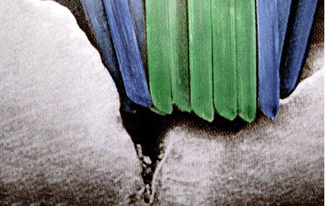 Zahnarztpraxis Dr. Isabel Selmair - München, Schwabing / Vorsorge Prophylaxe, Fissuren und Versiegelungen