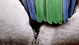 Zahnarztpraxis Dr. Isabel Selmair - München, Schwabing / Vorsorge Prophylaxe, Fissuren und Versiegelungen