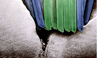 Zahnarztpraxis Dr. Isabel Selmair - München, Schwabing / Vorsorge Prophylaxe, Fissuren und Versiegelungen